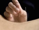 Belgische vereniging der geneesheren acupuncturisten